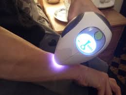 I feel the same sensation as the one used in laser hair removal centers. Tria Beauty Hair Removal Laser Better Than Ipl Review Part 2 Face Up Beauty
