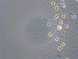 In medicine, a missed period is called. Reasons For Missed Period When You Re Not Pregnant By Dp Nguyen Medium