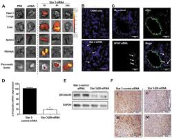 The pancreas is located in the upper abdomen behind the peritoneum between the stomach, spleen, liver and the large blood vessels of the pancreas. Targeted Therapies For Pancreatic Cancer And Hurdles Ahead Anticancer Research