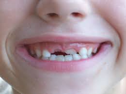 Enter Tooth Fairy Dentist Kids Teeth Dental