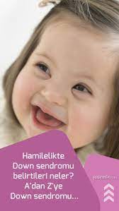 hamilelikte down sendromu belirtileri neler a dan z ye down sendromu down sendromu hamilelik genetik