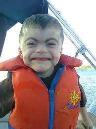 This is my son Tristan. He has Cornelia De Lange Syndrome (CDLS). He is  amazing! To learn more about CDLS go to www.cdlsusa.org/