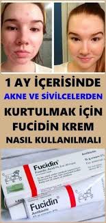 Pin On Dogal Saglik
