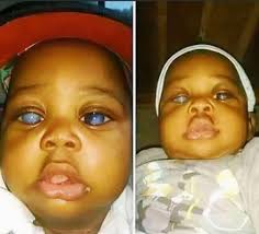 DNA and RNA is located in.......... (1) Mitochondria (2) Nucleus (3) Both