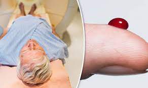 What causes prostate cancer is uncertain, but there are known risk factors, such as age or inherited genetic when prostate cancer is caught early, treatments can cure the disease. Blood Test Can Predict Aggressive Form Of Prostate Cancer Express Co Uk