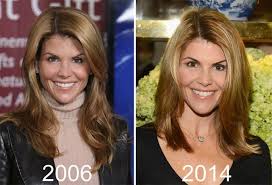 Stars whose procedures have gone wrong. Lori Loughlin Plastic Surgery Before And After Celebrity Plastic Surgery Lori Loughlin Lori Loughlin Hair