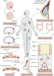 Image result for karp ln  tunel ort za