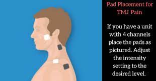 Pin On Tmj