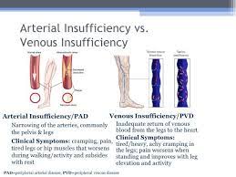 Difference Between Venous Insufficiency And Arterial Insufficiency Google Search Nurse Training Nursing School Survival Nursing School Prerequisites