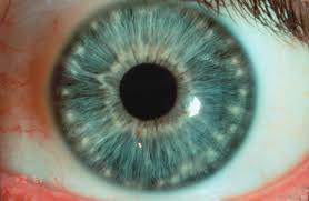 Rayid Iridology Naturopathic Care