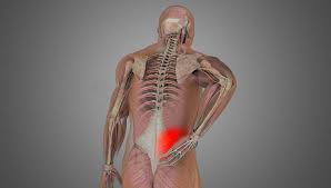 The pain usually results from problems with the musculoskeletal system —most notably the spine, including the bones of the spine (back bones, or vertebrae), disks, and the muscles and ligaments that support it. Low Back Sprain Strain Shimspine