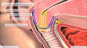 Image result for cervix position
