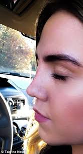 How to get a new nose WITHOUT going under the knife