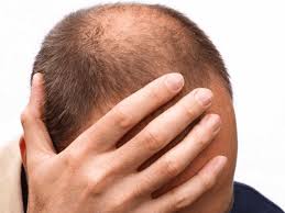 6 نصائح مهمة لتجنب الصلع وتفادي تساقط الشعر مجلتك