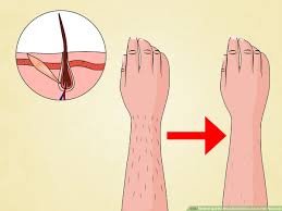 Laser hair removal is just what it sounds like, it is the use of laser light to remove hair from the body. How To Get The Most Benefit From Laser Hair Removal 11 Steps