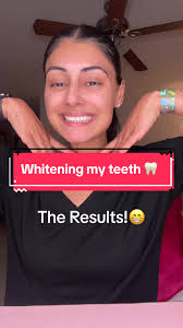These whitening strips slay @inopro.us 🦷 and sensitivity free!  #whiteningteeth #whiteningstrips #beautytok #teethwhitening