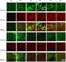 Identification Of Different Macrophage Subpopulations With Distinct Activities In A Mouse Model Of Oxygen Induced Retinopathy