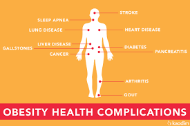 We did not find results for: The Scary Truth About Obesity In Malaysia And How To Prevent It
