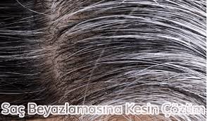 Sac Beyazlamasina Kesin Cozum Beyaz Sac Sac Dogal Sac