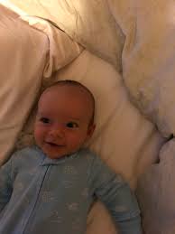 She was born with quite long hair, some fell but now it looks like she has a ring around the head, just above the ears, where hair is really thin. Joe Morrissey On Twitter 3 Months Old Today Losing Hair And Gaining Weight At Alarming Rates Welcome To The Real World Bud
