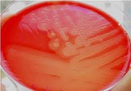 Double zone hemolysis produced by clostridium perfringens. Clostridium Perfringens Microbiology Clostridium Perfringens Labs Life