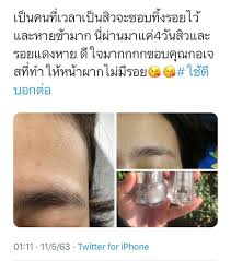 𝗚𝗼𝗿𝗴𝗲𝗼𝘂𝘀 กอเจส シ on instagram ร ว วจากทว ตก มา อยากหน าใสใช gorgeous ล กค าใช แค 4ว น รอยแดงต างๆลดลง หน าด ข น ป ญหา ส วไหนๆ กอเจสกำจ ดได