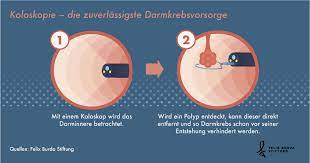Alternativ zur darmspiegelung können gesetzlich versicherte alle zwei jahre den zuvor beschriebenen test auf verborgenes. Darmkrebsvorsorge Darmkrebs De
