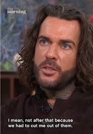 Joel Dommet Im A Celeb Talking about Pete Wicks