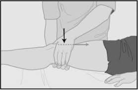 Image result for Patella Mobility Test