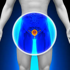 Image result for Bladder Irrigation