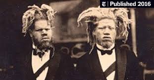 We did not find results for: How Two Black Albino Brothers Became Unwilling Sideshow Stars The New York Times