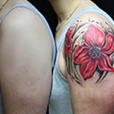 Digital journal is a digital media news network with thousands of digital journalists in 200 countries around the world. Tattoo Removal Allure Clinic