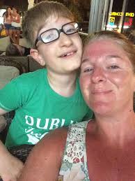 Nuneaton boy lived after born with brain outside his head