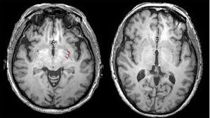 Why are there no good horror films any more? Horror On The Brain Finnish Researchers Map Mental Impact Of Watching Scary Movies Ctv News