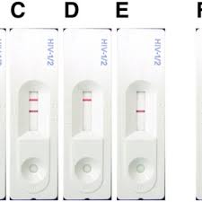 Possible Results For The Three Line Sd Bioline Hiv Rapid Diagnostic Download Scientific Diagram
