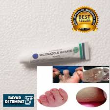 Biasanya selain sangat gatal, juga merah, dan kering. Salep Untuk Gatal Bintik Merah Salep Kulit Untuk Gatal Kering Shopee Indonesia