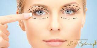 Goz Kapagi Estetigi Deneyimle Ve Uzman Kadro Op Dr Erdi Ozdemir