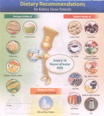 Kidney Stone Diet Chart 5 2020 Printable Calendar