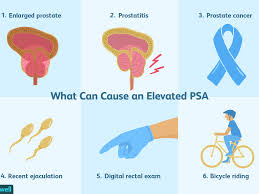 The total psa range of 4.0 to 10.0 ng/ml has been described as a diagnostic gray zone, in … Understanding Your Psa Results