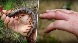 Pada jurnal tersebut termasuk sampai pemberian anestesi lokal pada sekitar luka gigitan. Inilah 10 Petua Jika Terkena Gigitan Serangga Berbisa Termasuk Lipan Petua Ibu