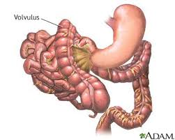 Image result for Volvulus