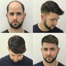 Choose a category that best describes the issue that you are having with the search Best Man Weaves And Lace Front Wigs For Men Hair Highway