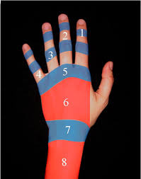 Lesion De Los Tendones Extensores De La Mano Cirugia De La Mano