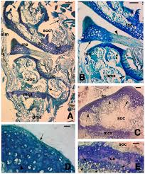 Solved D Question 10 1 Pts The Presence Of An Epiphyseal | Chegg.Com
