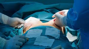 Breast surgery Treatment Hospital Bangalore | Breast surgery Doctors In  Bangalore | Breast surgery Hospital Near me - Ramakrishna Hospitals