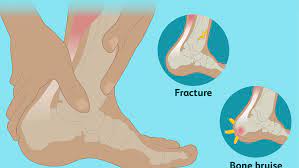 Inspection of the neck 17. Bone Pain Causes Treatment And When To See A Doctor