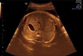 Wann wird zu einem organultraschall geraten? Organultraschall Feindiagnostik Dr Med D Prinz