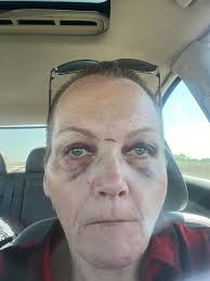 Asbestos exposure in TDCJ unit, what can be done?