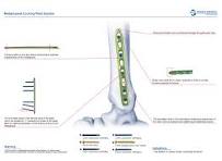 Metaphyseal Locking Plate System,Medical Device ...