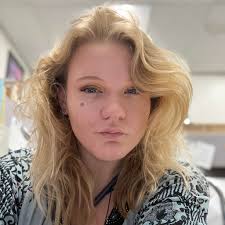 What happened to my ligaments after ankle injury?